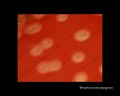 streptococcus pyogenes